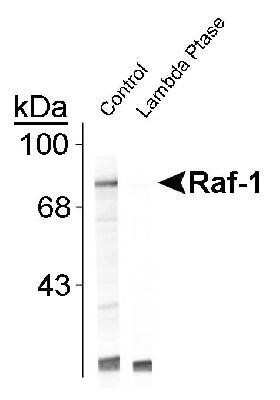 Western Blot: Raf1 [p Ser301] Antibody [NB300-305] - UV treated human Jurkat cell lysate showing specific immunolabeling of the ~74k Raf-1 protein (Control). The phosphospecificty of this labeling is shown in the second lane (lambda-phosphatase: lambda Ptase). The blot is identical to the control except that it was incubated in lambda Ptase (1200 units for 30 min) before being exposed to the Anti-Ser301< Raf-1. The immunolabeling of Raf-1 is completely eliminated by treatment with lambda Ptase.